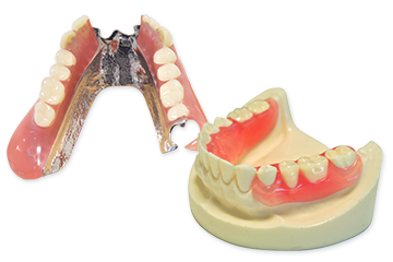 スマートデンチャーで目立たない入れ歯