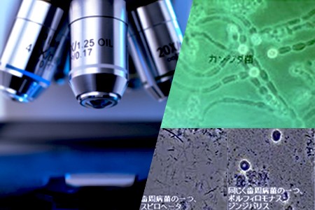 歯周病は、細菌による感染症です