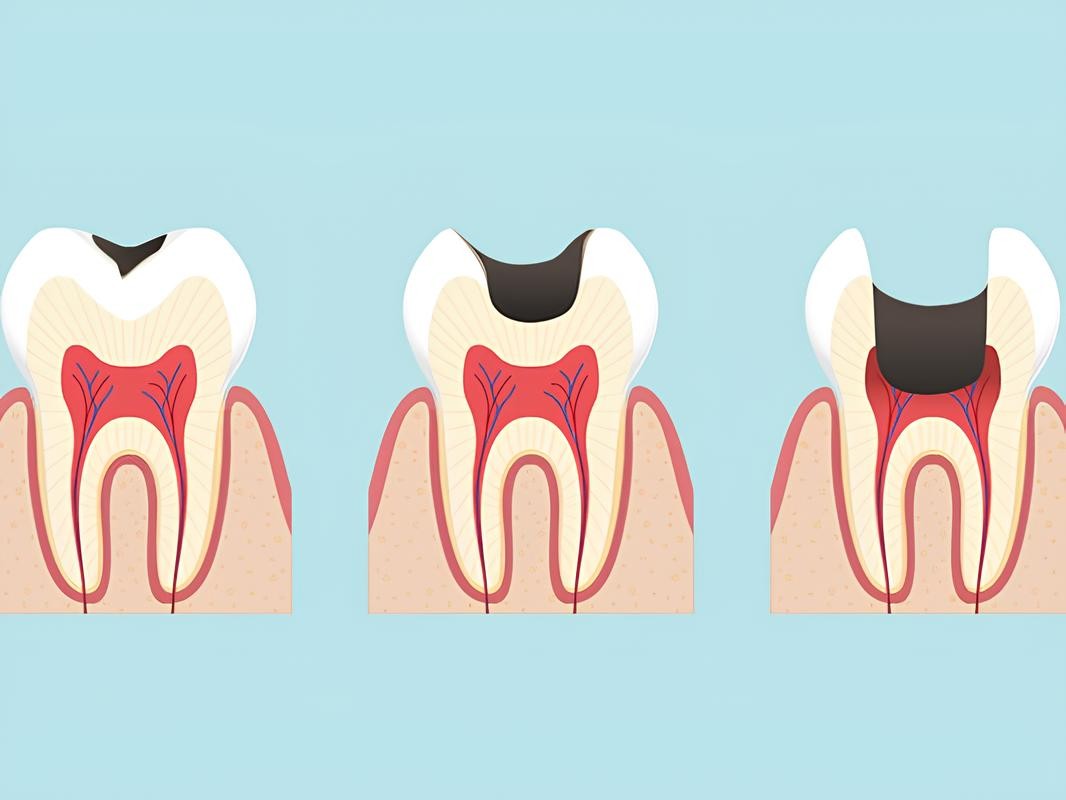 無理な治療はしません