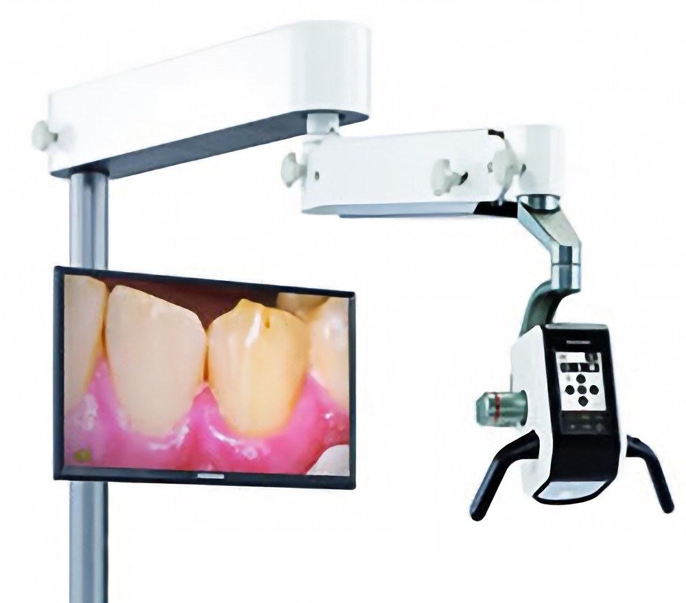 デジタルマイクロスコープを導入