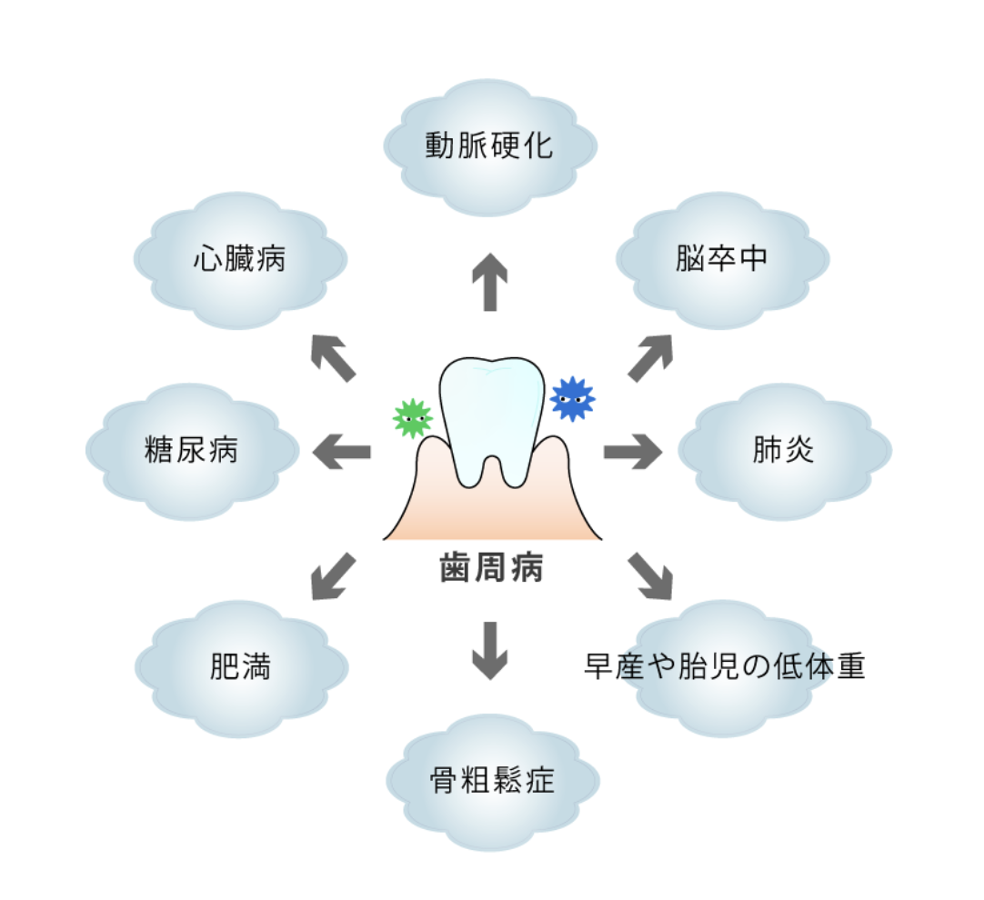 歯周病の管理は、お口の健康だけでなく、全身の健康維持にもつながります