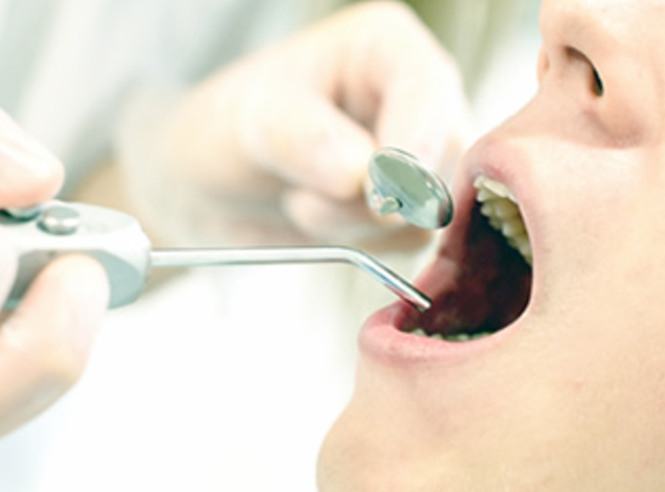 予防歯科で健康な歯を長く維持