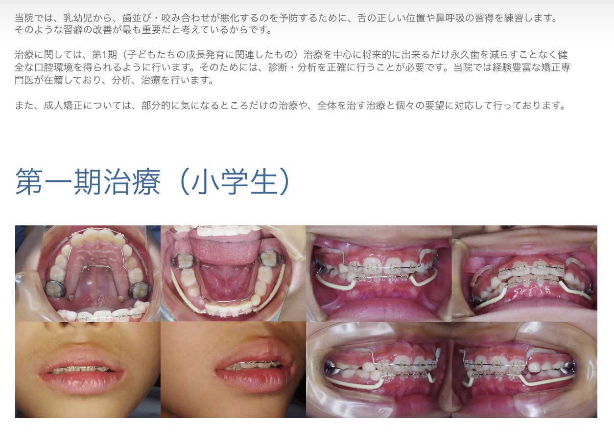 患者様の要望に沿った治療を行っています