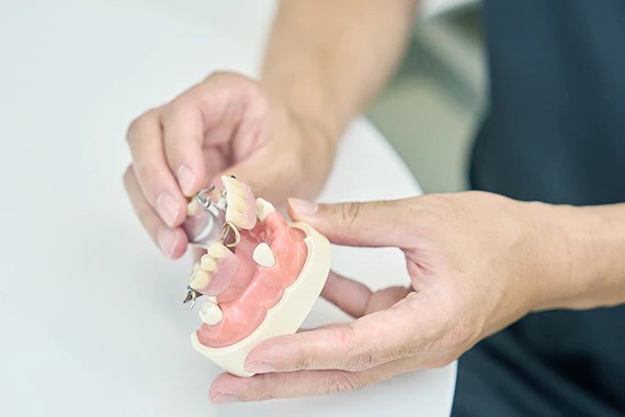 入れ歯のお悩みに幅広く対応しています