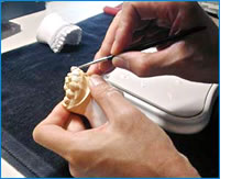 高い技術できれいな歯をお作りします