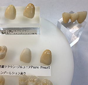 ジルコニアを用いた治療