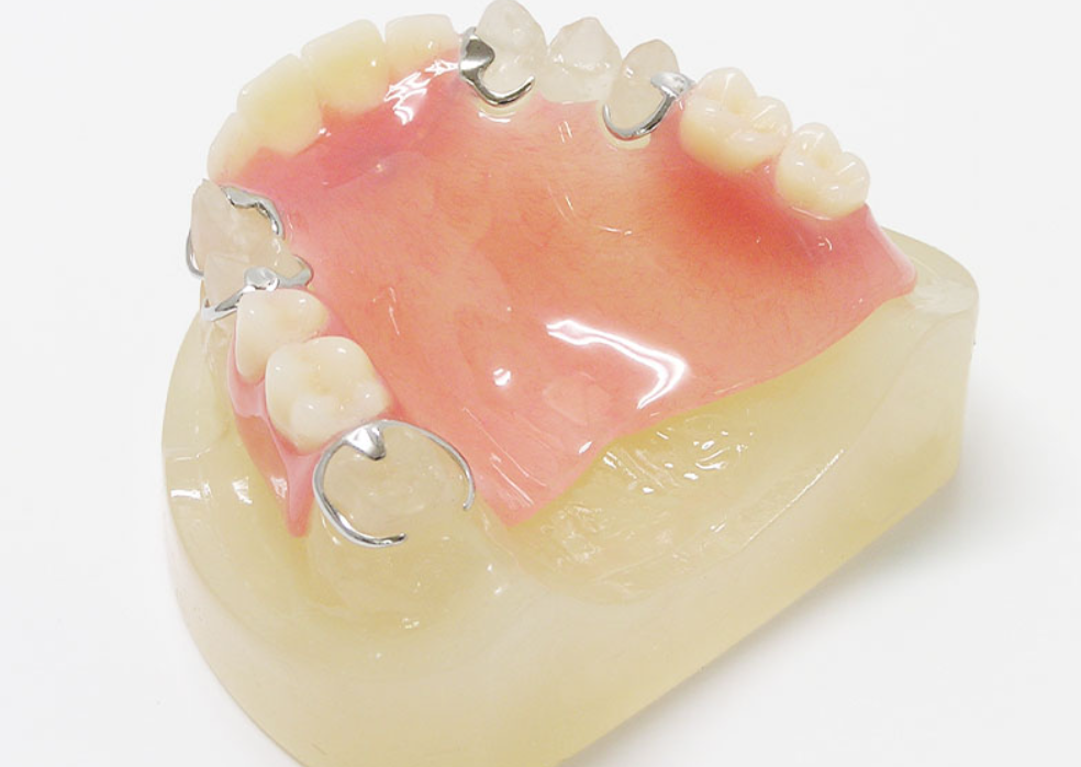 機能性と審美性を兼ね備えた入れ歯で、豊かな食生活を実現します