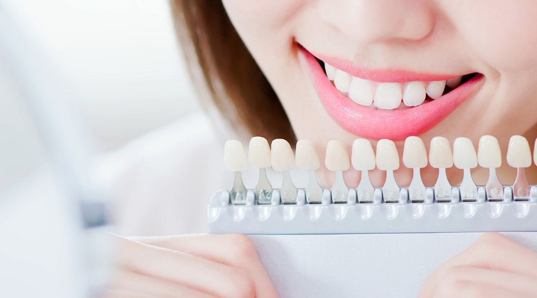 白い歯の輝きを取り戻す