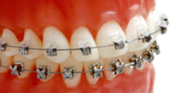 デーモンシステムを導入しています