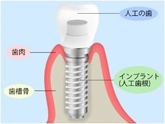 治療後は10年保証システム「ガイドデント」によって長期的なサポートも受けられます