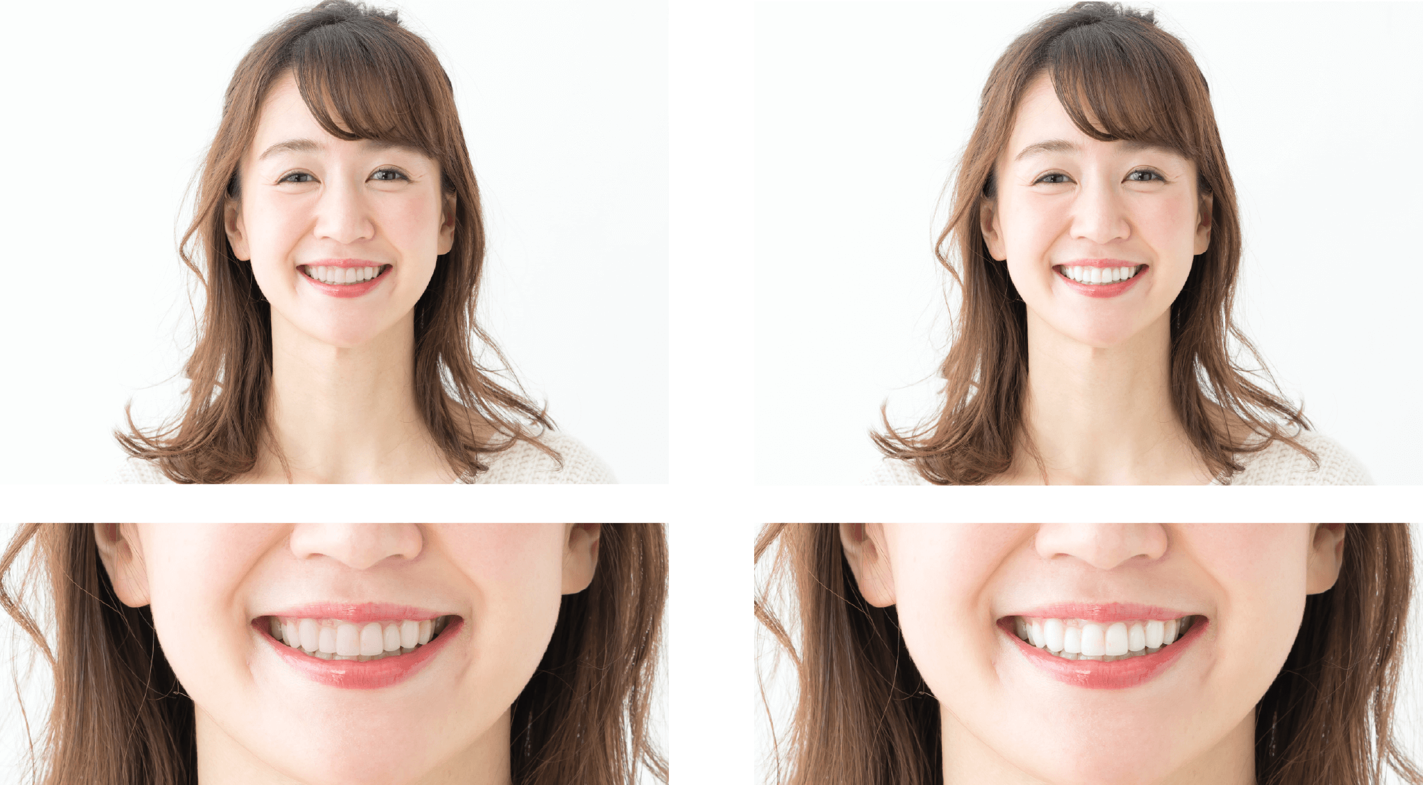 歯が白いとお顔が若々しく見えます