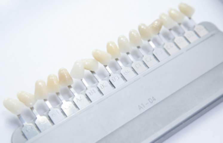 抜歯を回避するための選択肢