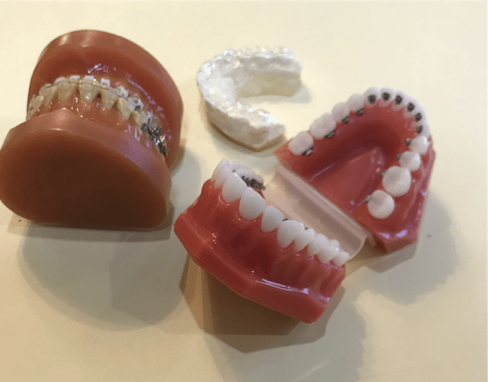 さまざまな矯正装置を用意しています