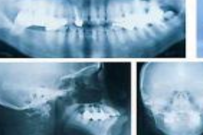 繰り返す口内炎も治療可能です