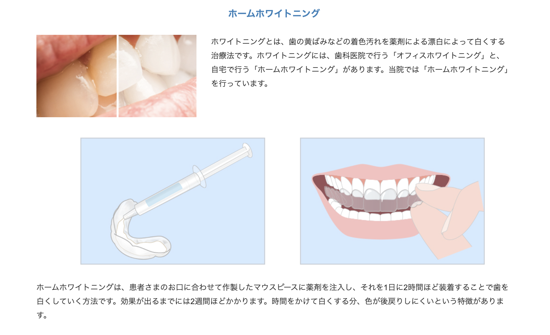 機能性だけでなく見た目にも配慮した審美歯科治療をご提供しています