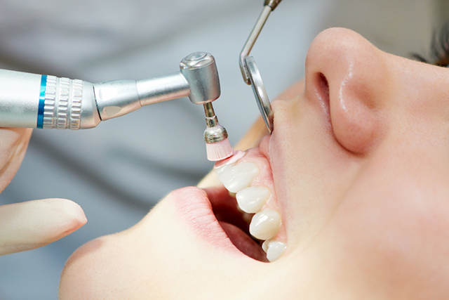 歯を大きく削ることになってしまう前に、定期的な歯科受診を行いましょう