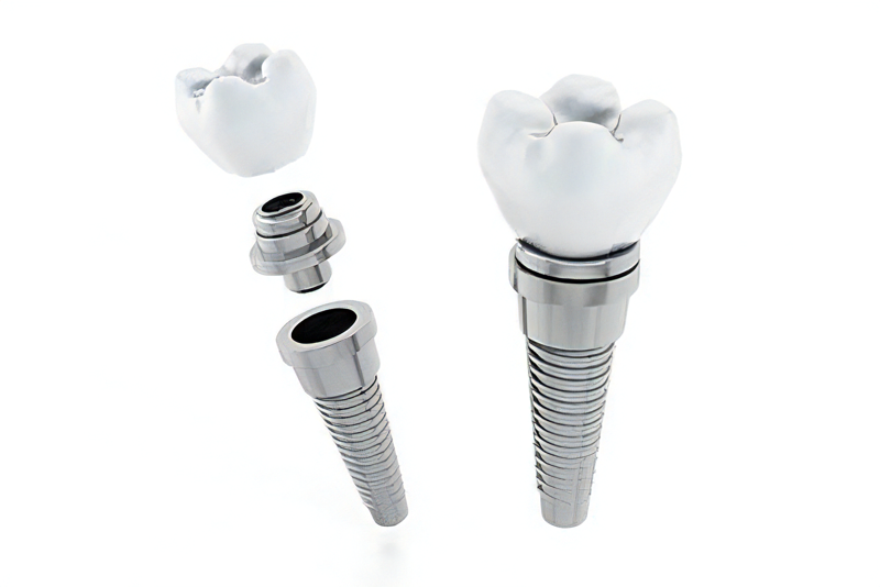 インプラント治療を提供