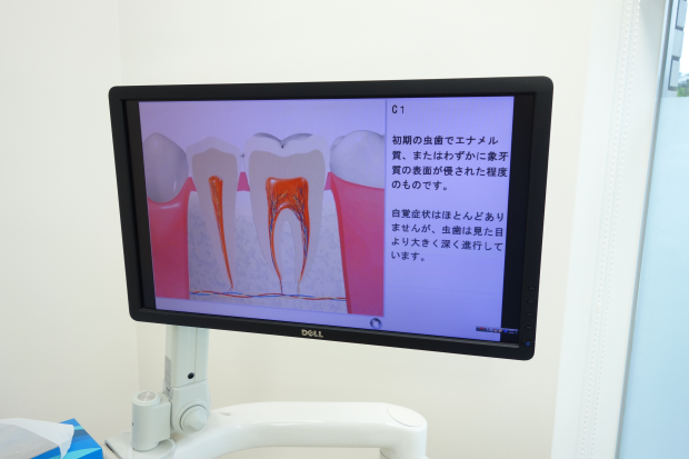 モニターにてわかりやすくご説明を行っています