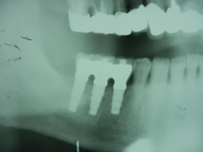 痛みも負担も少なく、笑顔を取り戻す