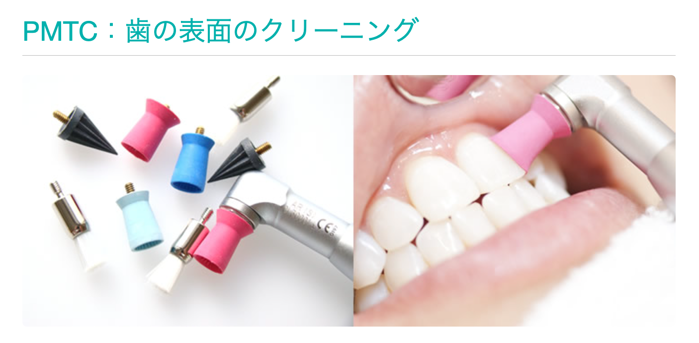 定期的な検診とクリーニングを通じて、患者様の口腔内を健康に保つサポートを行っています