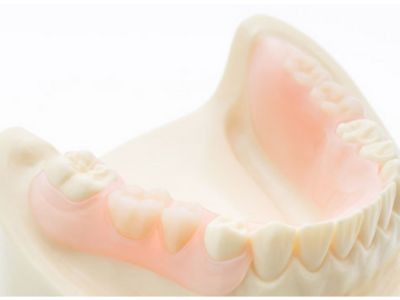 エステショット（バネのない入れ歯）