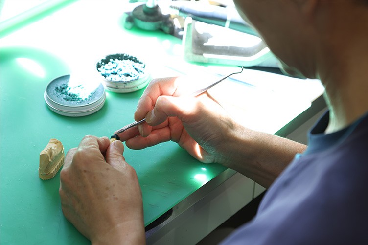 歯科技工士と連携しながら細かな調整を行いやすく、装着感や噛み心地の改善にも柔軟に対応することが可能です