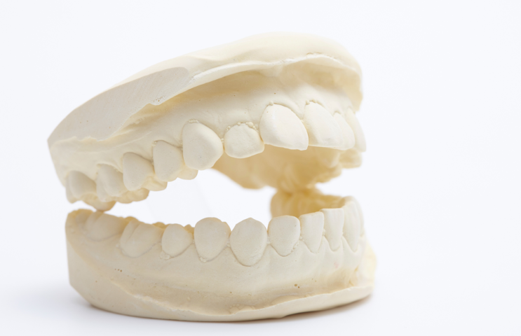 入れ歯の常識を問い直す精密設計