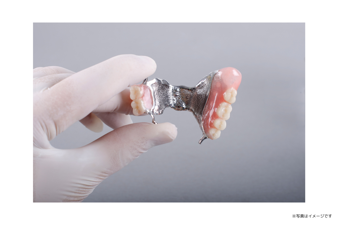 入れ歯・義歯に関するお悩みに対し、患者様の希望や症状に合わせた丁寧な対応を行っています