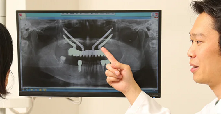 【インプラント専門医　在籍】【インプラント治療5000本以上】インプラント治療は恵比寿山田歯科医院にお任せください