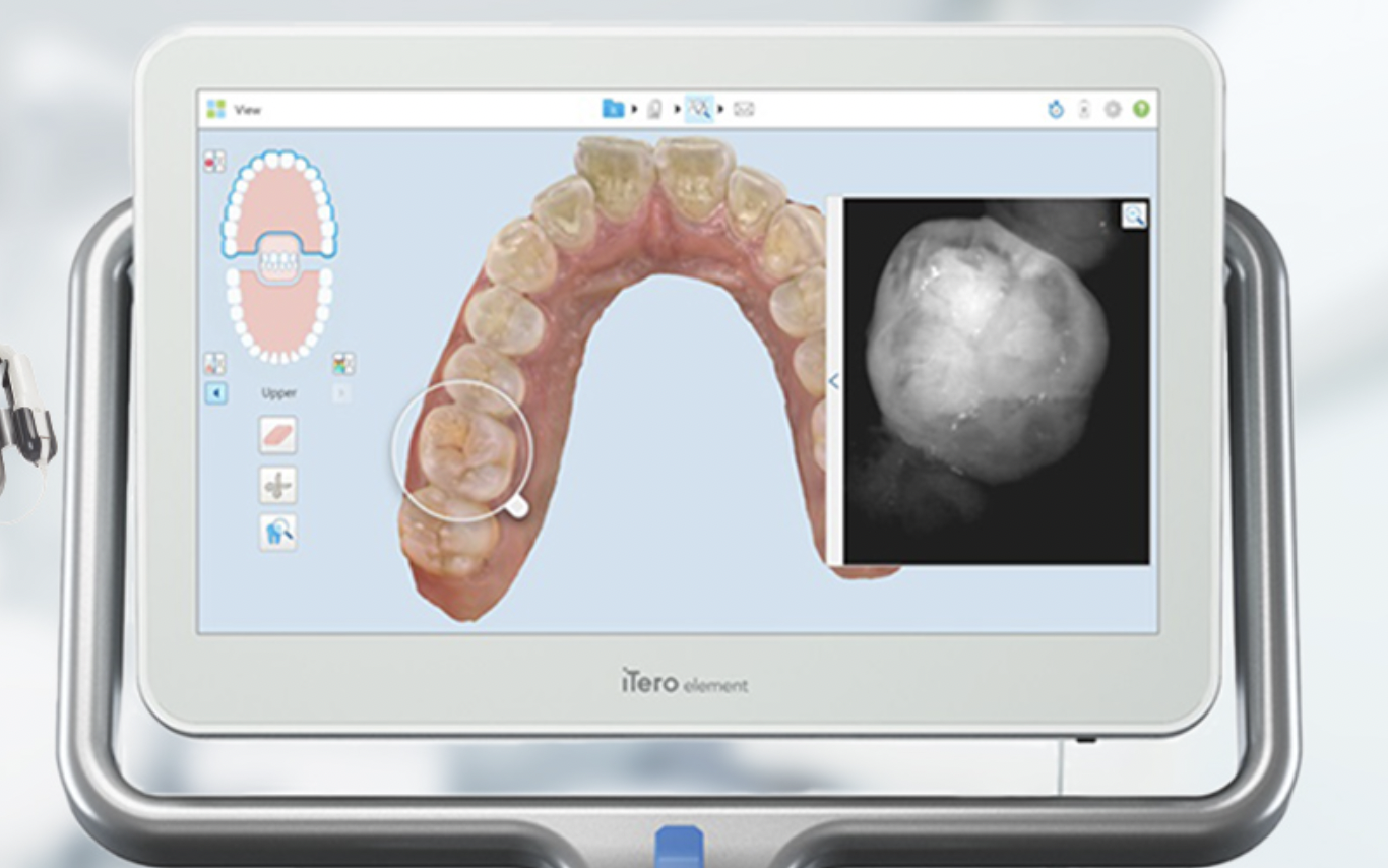 得意とする矯正治療