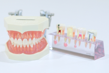 快適な入れ歯をスピーディにお作りします