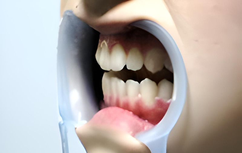 天然歯に近い素材と精密な技術で理想の口元を実現