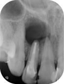 歯を残したい方はぜひご相談ください