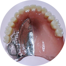 患者様にとって、より快適で長持ちする入れ歯を提供できるよう、細やかな対応を心掛けています