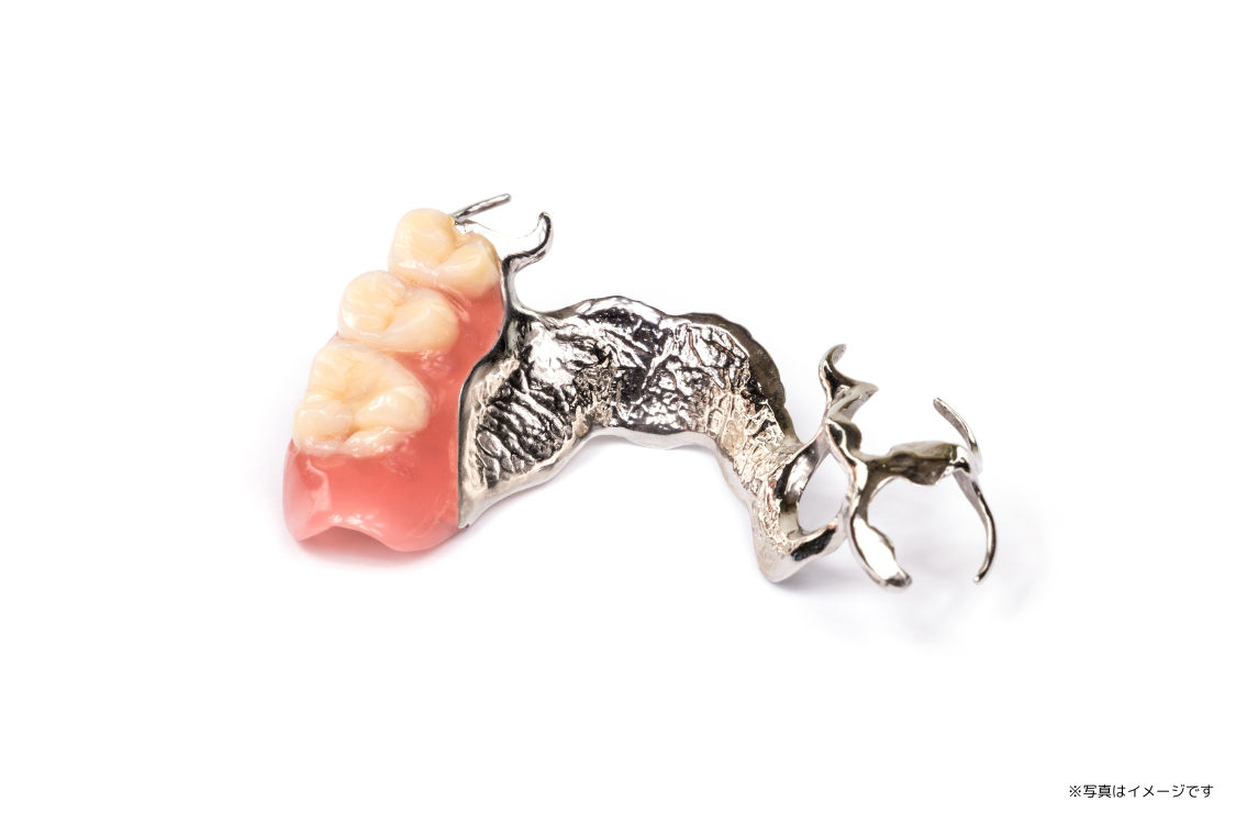 作成後の調整やメンテナンスも重視しており、残った歯を大切にするためにも定期検診を推奨しています