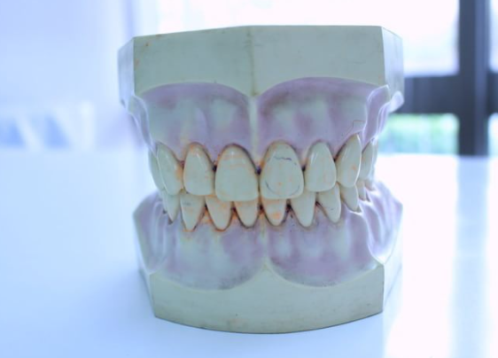 患者様の生活の質を高めるために、納得していただける治療法を提案し、快適で機能的な義歯治療を提供しています。