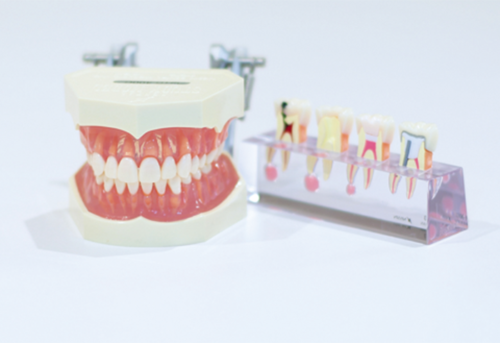 事前に、しっかりとお話をした上で治療を始めます。