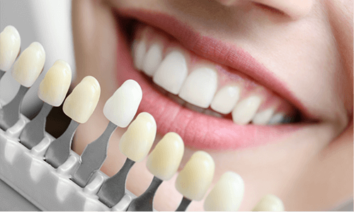 効果的で手軽に行えるホワイトニング治療を提供しています