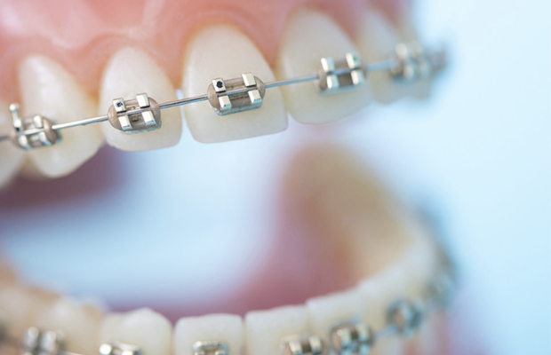 歯並びや噛み合わせを整えることで、見た目の改善だけでなく、お口の機能向上にもつながります