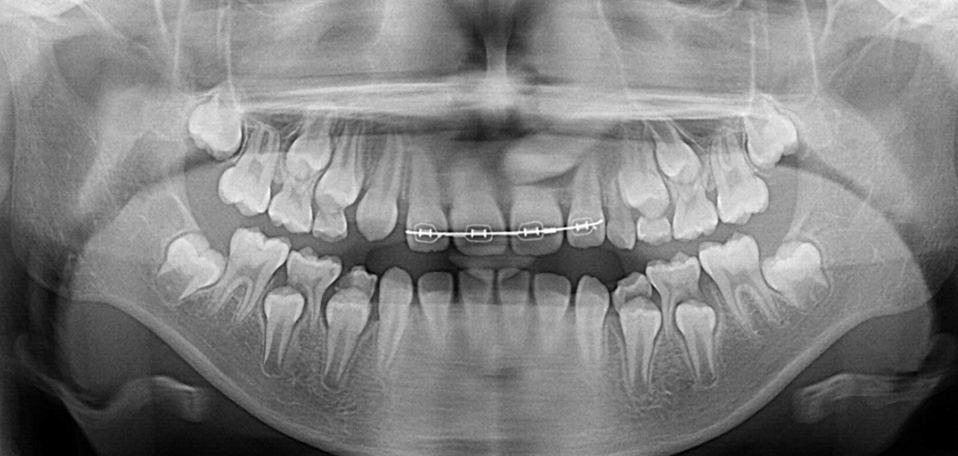 長期的に安定した治療結果を目指します。
