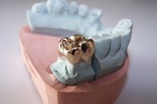 金属アレルギーがあっても大丈夫です