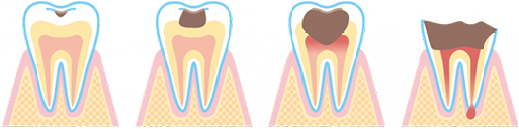 虫歯治療はもちろん、定期的な歯科検診や予防ケアも行っており、患者様の口内健康を長期的にサポートしています