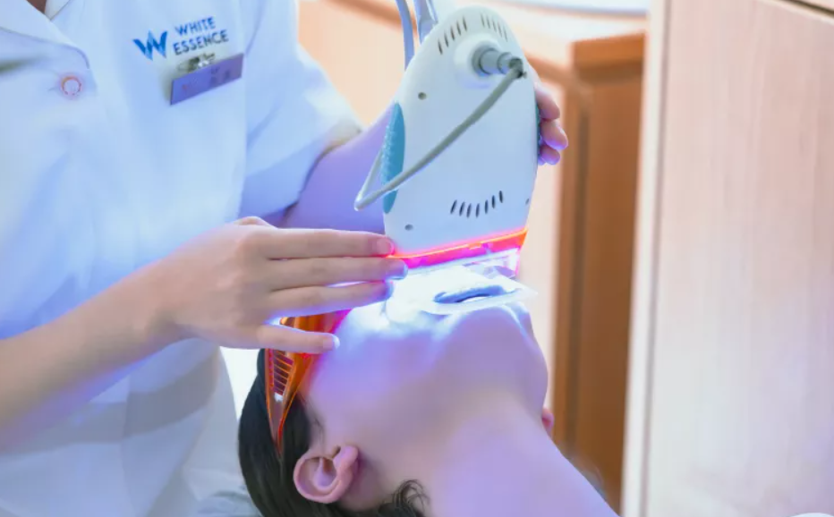 安全でホワイトニング効果の高い、光活性装置を使用したホワイトニング照射器を導入しています