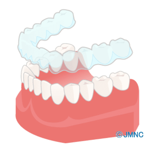 インビザラインを取り扱っています