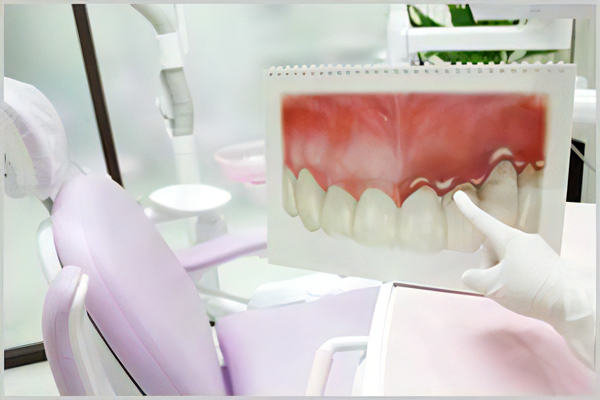 歯周病治療を提供