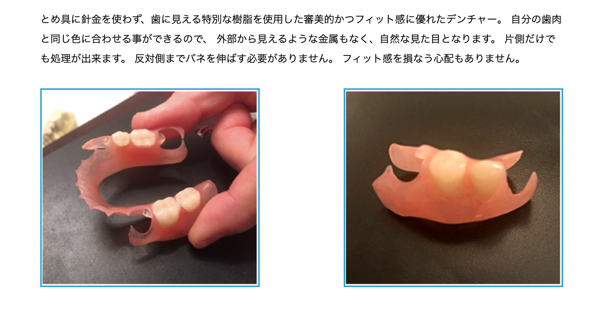 失われた歯の機能と見た目を補う治療で、患者様の快適な咀嚼や自然な口元を取り戻すことを目指します