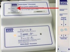 無痛治療に力を入れており、7つの工夫を組み合わせています
