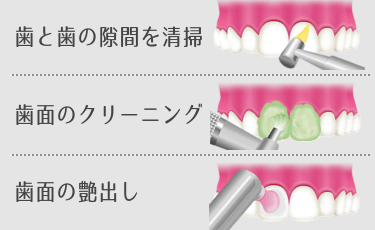 進行する虫歯や歯周病の早期発見・早期治療が、健康な歯を保つ秘訣です