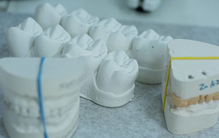 再発を防ぐ予防歯科で健やかな口元を維持