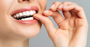 目立たず整える、美しい歯並び